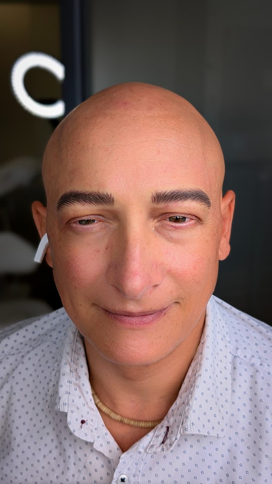 Risultato finale trattamento