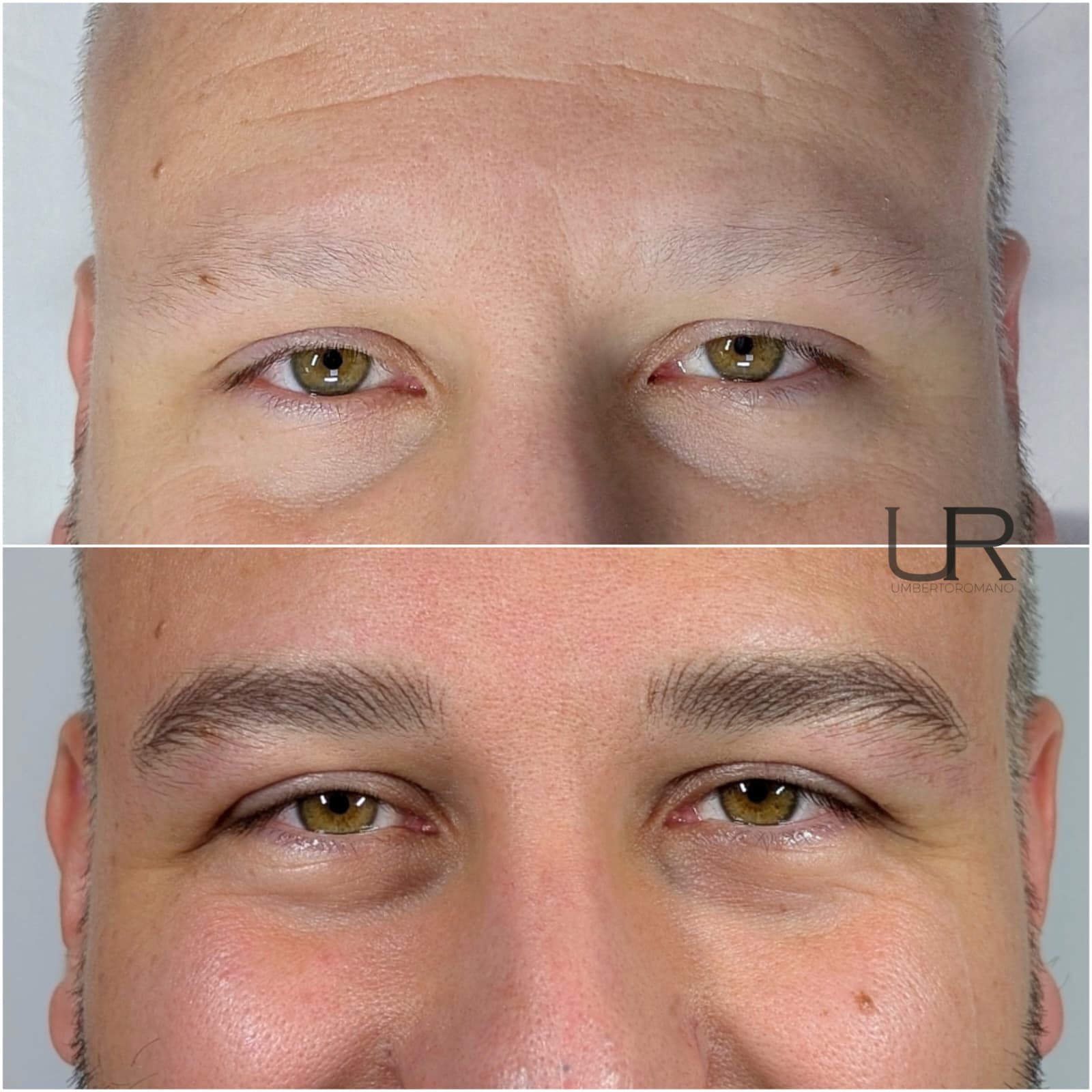 Risultato trattamento prima e dopo