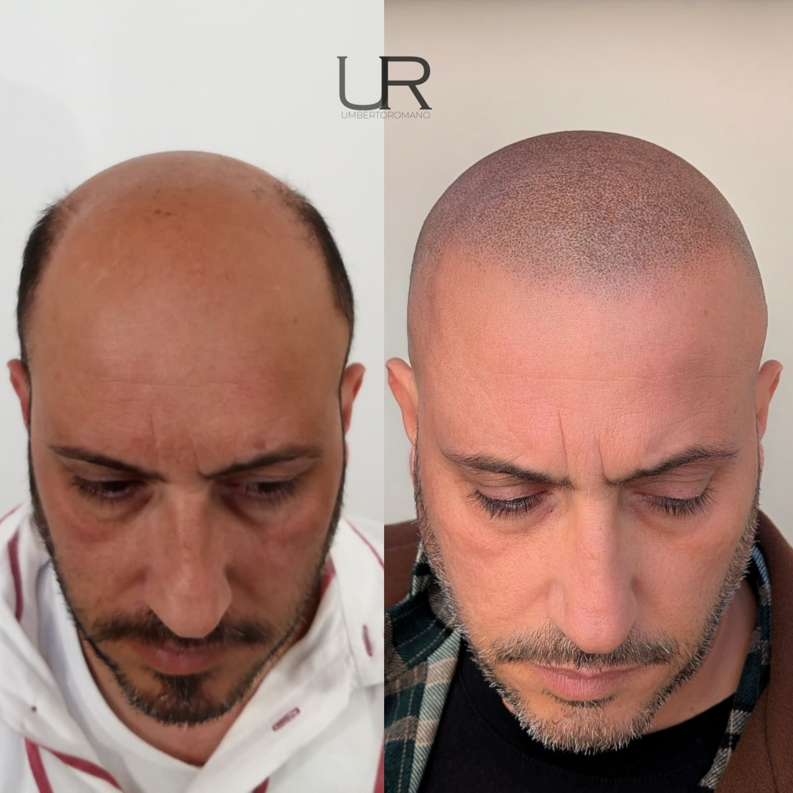 Risultato trattamento prima e dopo