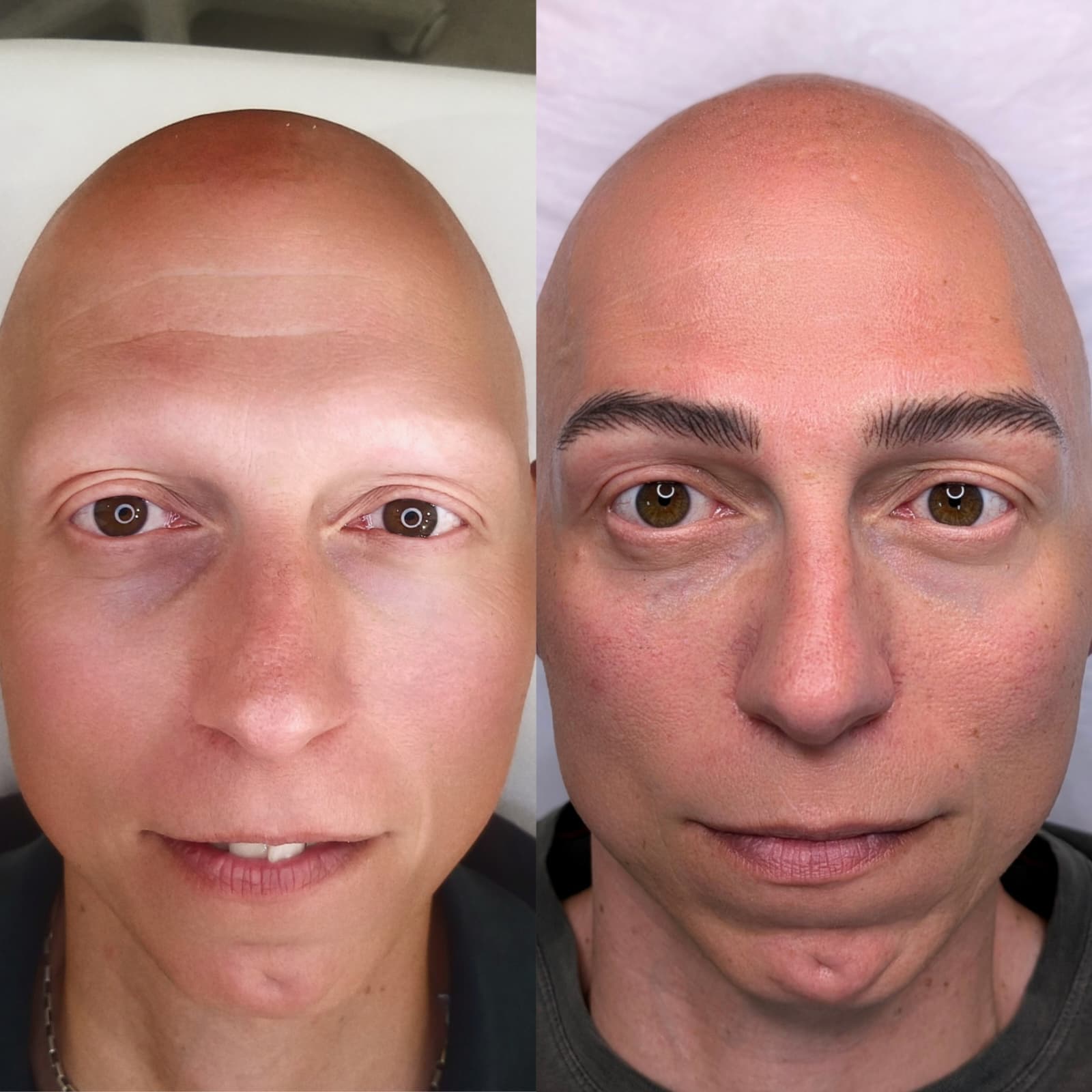 Risultato trattamento prima e dopo